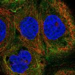 SLC1A6 Polyclonal Antibody