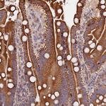 ATXN2L Antibody in Immunohistochemistry (Paraffin) (IHC (P))