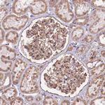 ATXN2L Antibody in Immunohistochemistry (Paraffin) (IHC (P))
