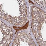 ATXN2L Antibody in Immunohistochemistry (Paraffin) (IHC (P))