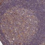 ATXN2L Antibody in Immunohistochemistry (Paraffin) (IHC (P))