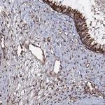 KXD1 Antibody in Immunohistochemistry (Paraffin) (IHC (P))