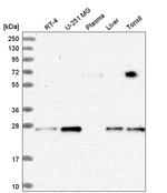 KXD1 Antibody in Western Blot (WB)