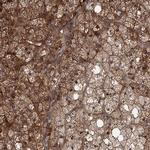 DEXI Antibody in Immunohistochemistry (IHC)