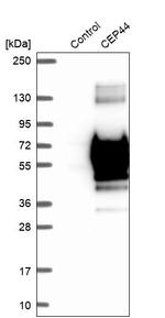 CEP44 Antibody in Western Blot (WB)