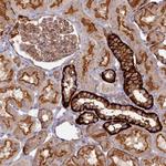 PSMG2 Polyclonal Antibody