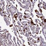 MAN2B1 Antibody in Immunohistochemistry (Paraffin) (IHC (P))