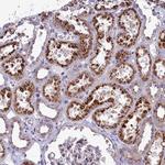 MAN2B1 Antibody in Immunohistochemistry (Paraffin) (IHC (P))