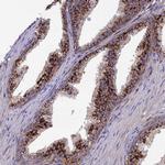 MAN2B1 Antibody in Immunohistochemistry (Paraffin) (IHC (P))