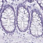 Sarcalumenin Antibody in Immunohistochemistry (IHC)