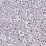 CCDC86 Antibody in Immunohistochemistry (Paraffin) (IHC (P))