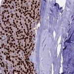 CCDC86 Antibody in Immunohistochemistry (IHC)