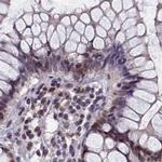 CCDC86 Antibody in Immunohistochemistry (IHC)