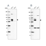 CCDC86 Antibody in Western Blot (WB)