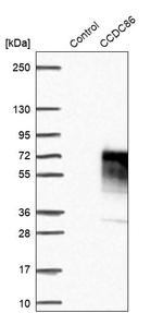 CCDC86 Antibody in Western Blot (WB)