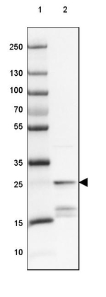 PPP1R1A Antibody in Western Blot (WB)
