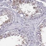 PRSS54 Antibody in Immunohistochemistry (IHC)