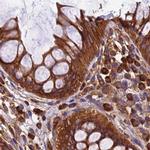 KARS Antibody in Immunohistochemistry (IHC)