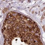 KARS Antibody in Immunohistochemistry (IHC)
