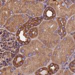 KARS Antibody in Immunohistochemistry (IHC)