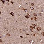 KARS Antibody in Immunohistochemistry (IHC)
