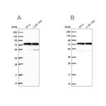 KARS Antibody in Western Blot (WB)