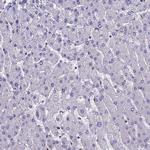 LCMT1 Antibody in Immunohistochemistry (Paraffin) (IHC (P))