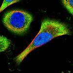 C15orf59 Polyclonal Antibody