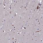 C15orf59 Antibody in Immunohistochemistry (Paraffin) (IHC (P))