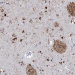 C16orf72 Polyclonal Antibody