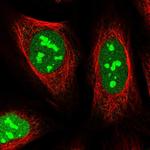 TMA16 Polyclonal Antibody