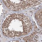 TMA16 Antibody in Immunohistochemistry (Paraffin) (IHC (P))