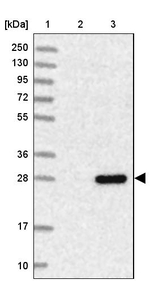 TMA16 Antibody in Western Blot (WB)