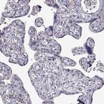 PABPC1L2A Antibody in Immunohistochemistry (Paraffin) (IHC (P))