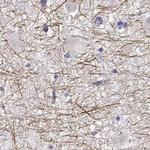 PABPC1L2A Antibody in Immunohistochemistry (IHC)