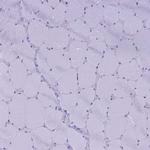 FAM169A Antibody in Immunohistochemistry (Paraffin) (IHC (P))