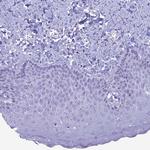 FAM169A Antibody in Immunohistochemistry (Paraffin) (IHC (P))