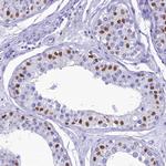 FAM169A Antibody in Immunohistochemistry (Paraffin) (IHC (P))