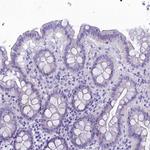 FAM169A Antibody in Immunohistochemistry (IHC)