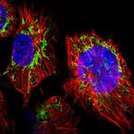 WDR22 Polyclonal Antibody