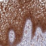 TSPAN16 Polyclonal Antibody