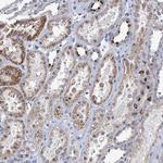 TMEM221 Polyclonal Antibody