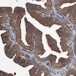 MDM1 Antibody in Immunohistochemistry (Paraffin) (IHC (P))