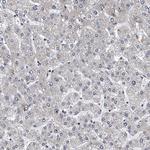 MDM1 Antibody in Immunohistochemistry (Paraffin) (IHC (P))