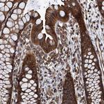 MDM1 Antibody in Immunohistochemistry (Paraffin) (IHC (P))