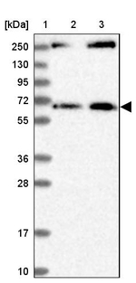 MDM1 Antibody in Western Blot (WB)