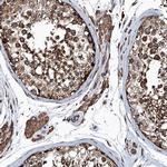 MDM1 Antibody in Immunohistochemistry (IHC)