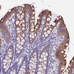 GCAP3 Antibody in Immunohistochemistry (Paraffin) (IHC (P))