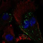 GCAP3 Polyclonal Antibody