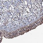 KXD1 Antibody in Immunohistochemistry (Paraffin) (IHC (P))